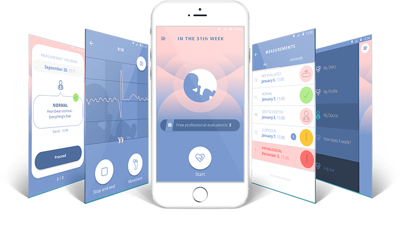 BabyCTG application user interface