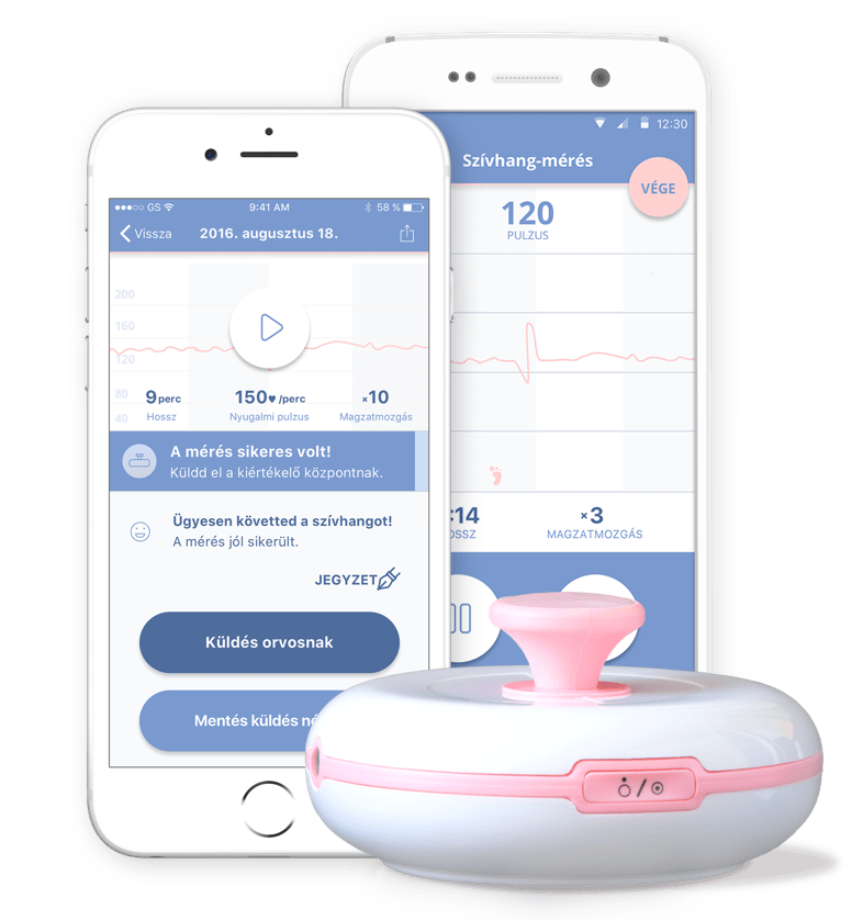 user interface design on smartphones and sensor of BabyCTG